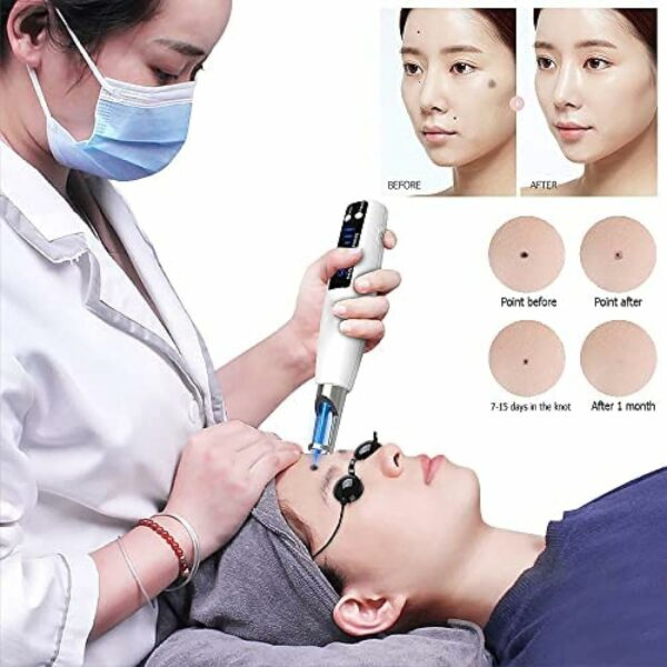 Caneta Laser De Picossegundos Caneta Para Remoção De Tatuagem - Imagem 7