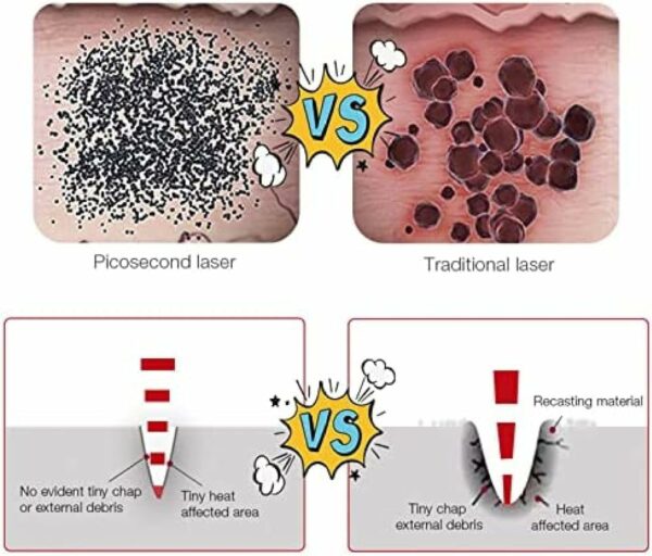 Caneta Laser De Picossegundos Caneta Para Remoção De Tatuagem - Imagem 6